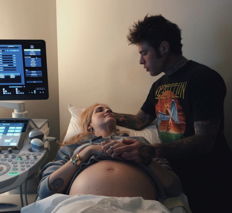 fedez chiara ferragni