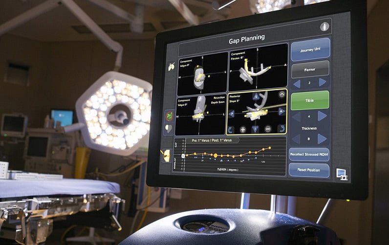 Ecco Navio, un robot per protesi al ginocchio precise al millimetro: prima volta in Puglia a Conversano