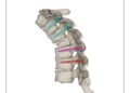Neurochirurgia Vertebrale Di Venere (1)