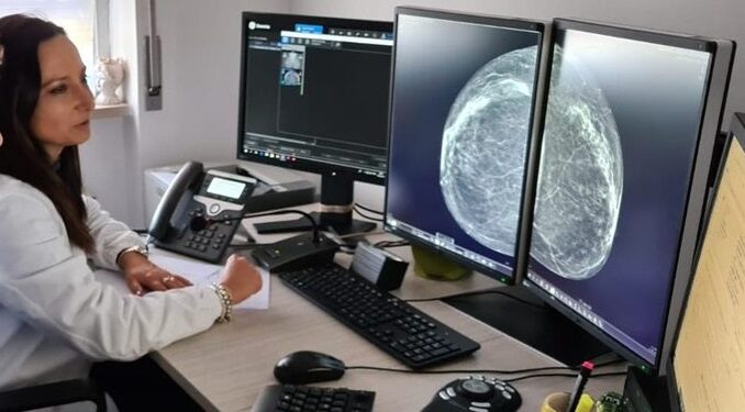 Screening Mammografico